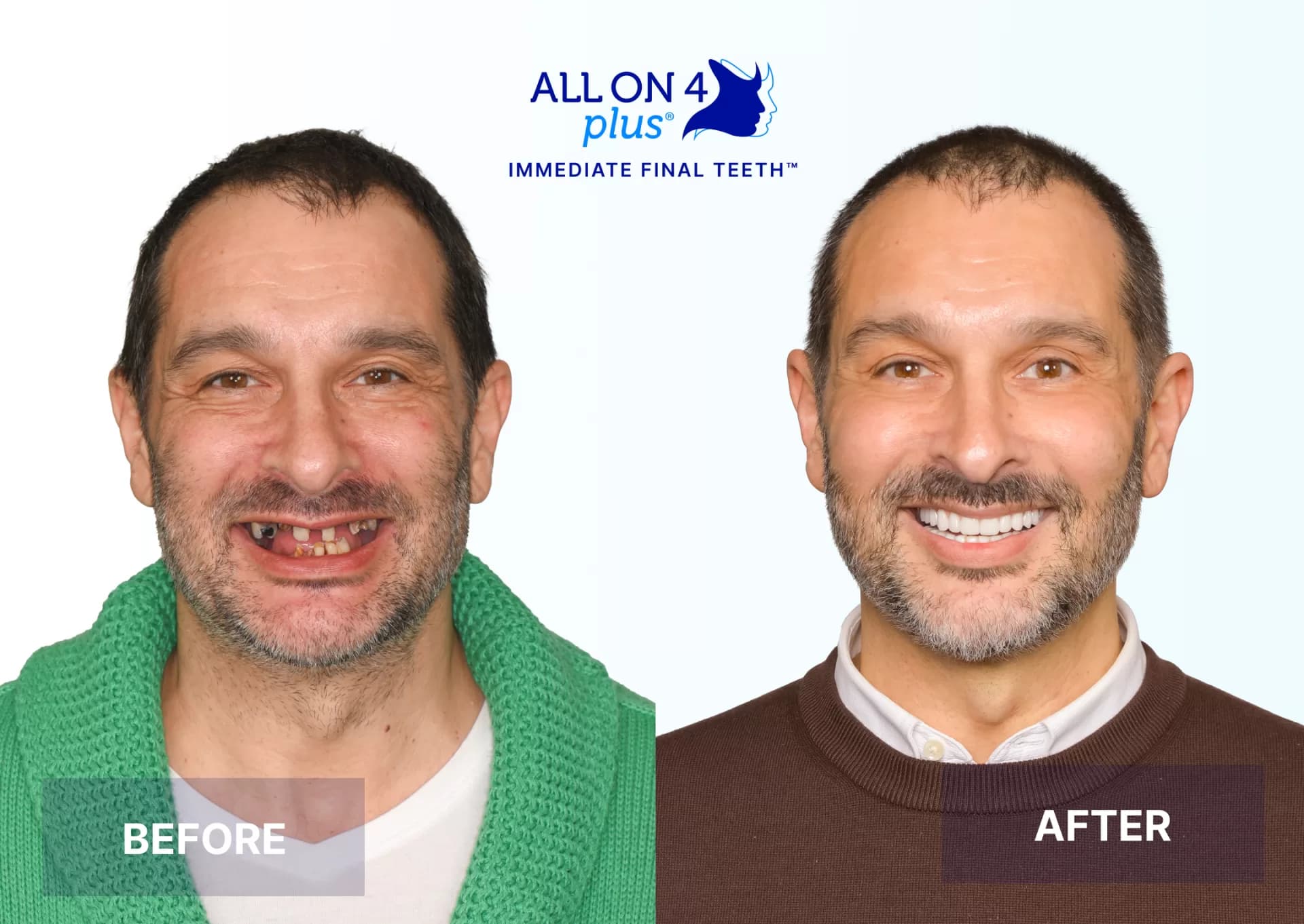 Patient 1- Nicholas Weinberg