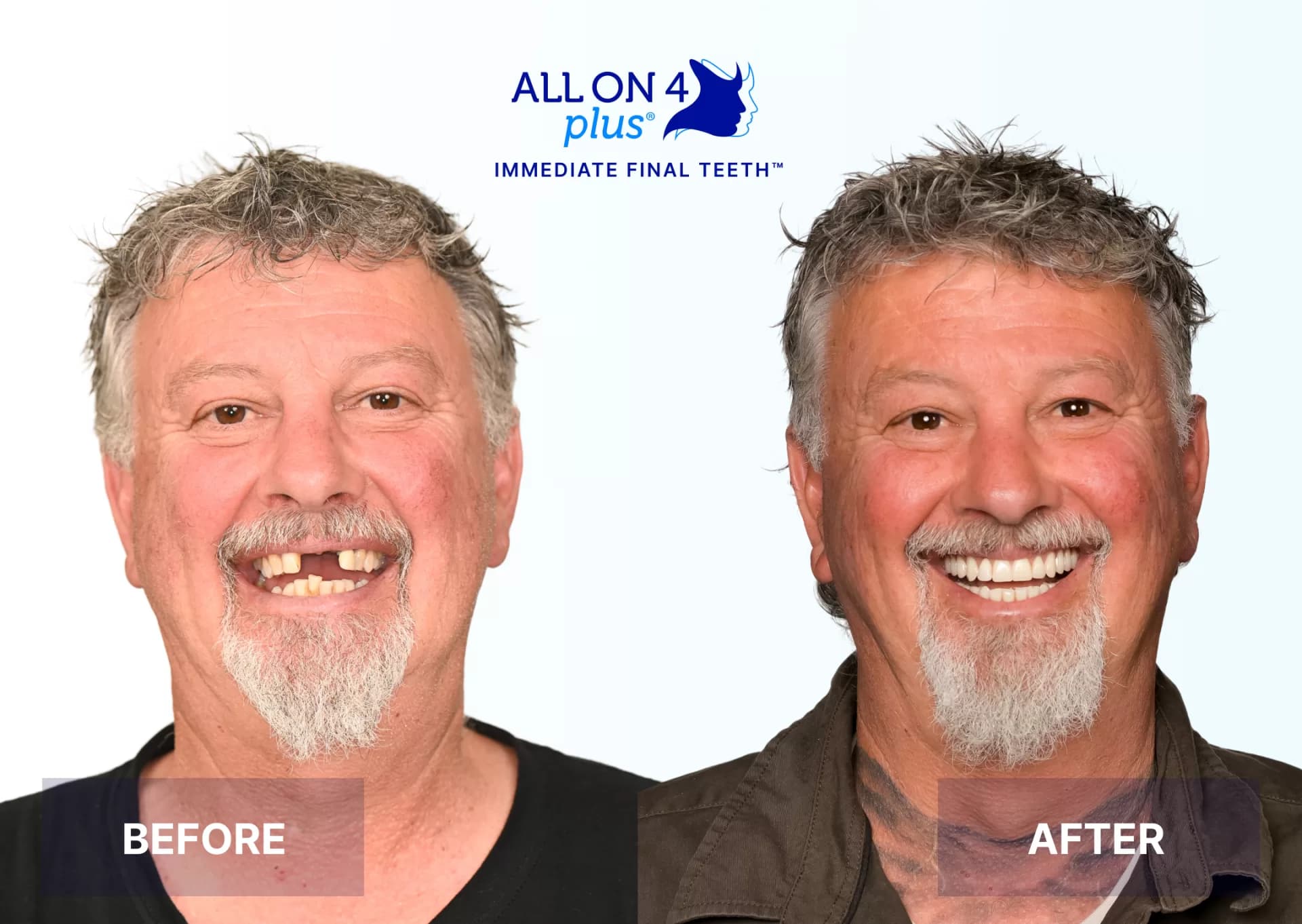 Patient 2- Wayne Fowler