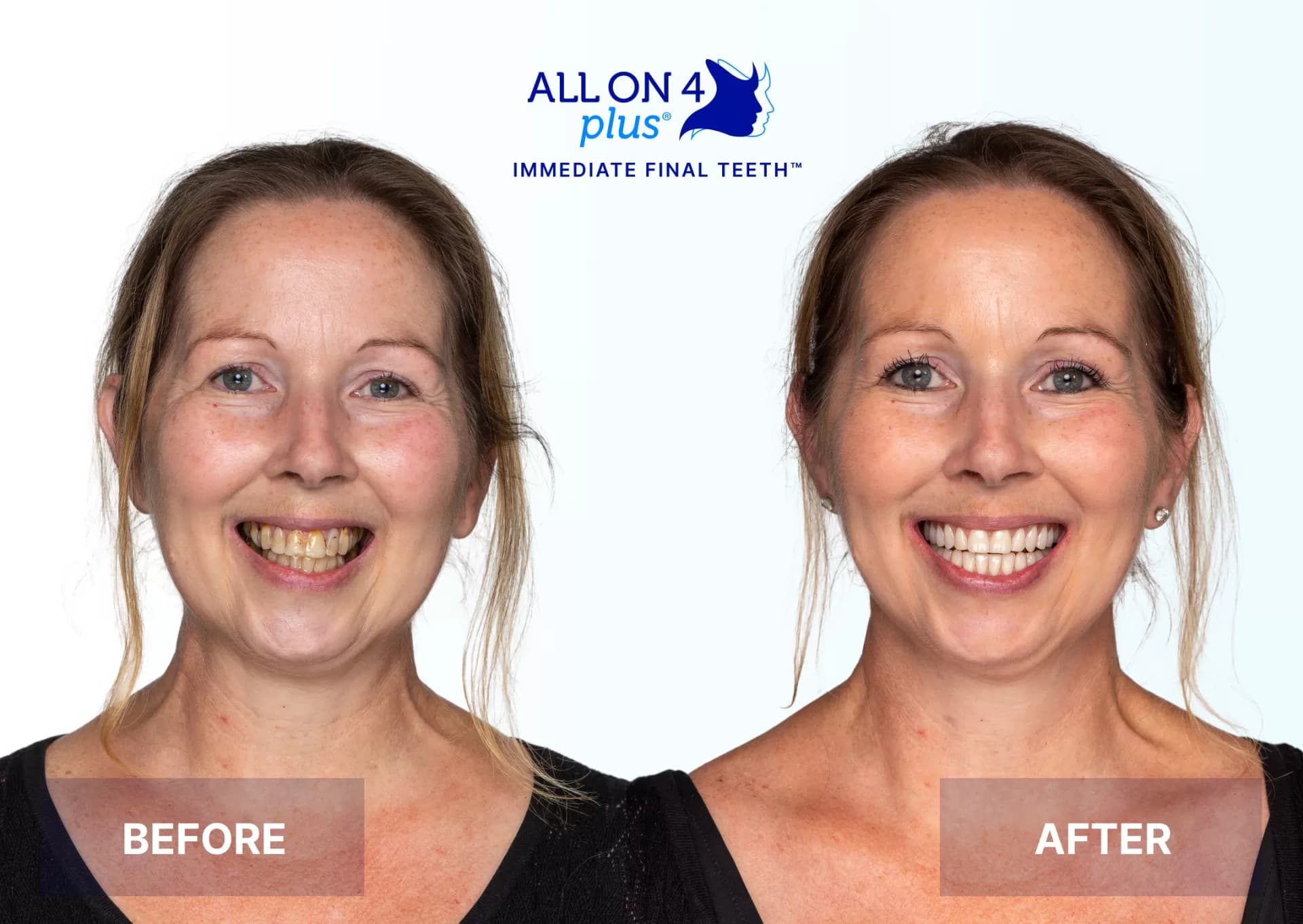 Patient 3- Susan Humphrey