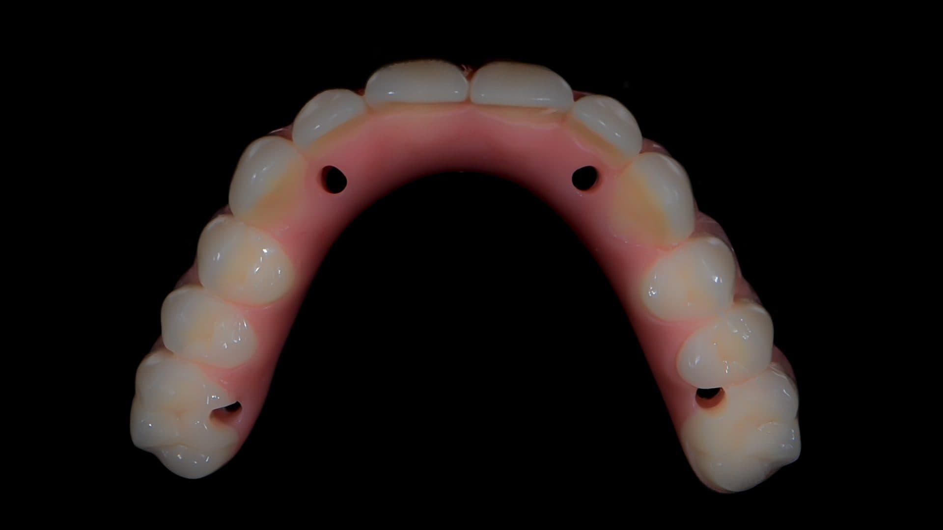 All On 4 Clinic Dr Alex Fibishenko Four Dental Implants 2 DSC 1186 Web