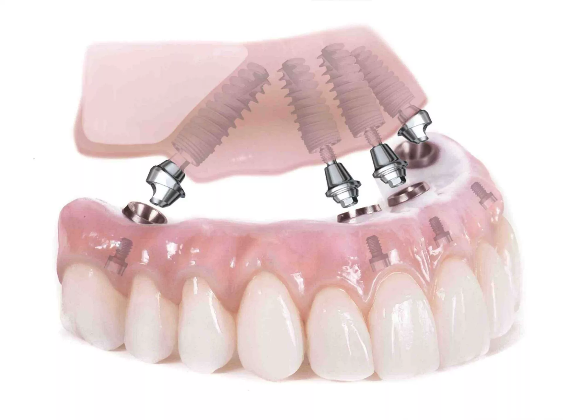 Teeth image 1
